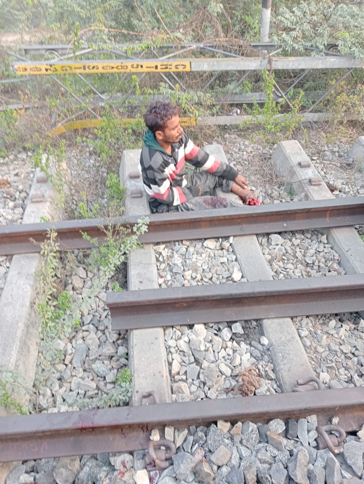 ट्रेन  की चपेट में आने से युवक का एक पैर कटा